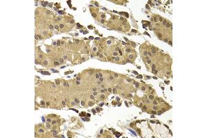 Immunohistochemistry of paraffin-embedded human stomach using SETD5 antibody (ABIN4905135) at dilution of 1:100 (40x lens). (SETD5 antibody)