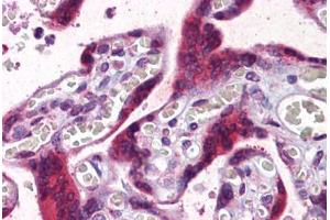 Human Placenta: Formalin-Fixed, Paraffin-Embedded (FFPE) (PGRMC2 antibody  (AA 124-224))