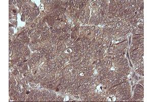 Image no. 2 for anti-Mitogen-Activated Protein Kinase Kinase 3 (MAP2K3) antibody (ABIN1499406) (MAP2K3 antibody)