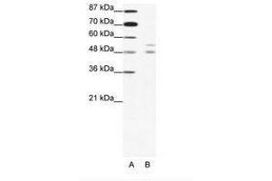 Image no. 1 for anti-Microphthalmia-Associated Transcription Factor (MITF) (N-Term) antibody (ABIN203124) (MITF antibody  (N-Term))