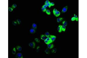 Immunofluorescence staining of Hela cells with ABIN7153633 at 1:166, counter-stained with DAPI. (GJD2 antibody  (AA 99-197))