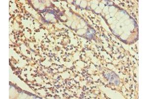 Immunohistochemistry of paraffin-embedded human small intestine tissue using ABIN7167765 at dilution of 1:100 (ALDH1A1 antibody  (AA 202-501))