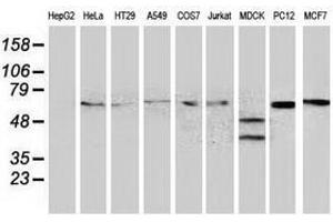 Image no. 3 for anti-Beclin 1, Autophagy Related (BECN1) antibody (ABIN1496866) (Beclin 1 antibody)