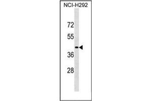 Western blot analysis of LIPN Antibody (C-term) in NCI-H292 cell line lysates (35ug/lane). (LIPN antibody  (C-Term))