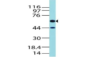 Image no. 1 for anti-Activin A Receptor Type II-Like 1 (ACVRL1) (AA 326-503) antibody (ABIN5027022) (ACVRL1 antibody  (AA 326-503))