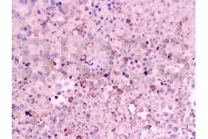 Formalin-fixed and paraffin embedded mouse lymphoma tissue labeled Anti-CD8 Polyclonal Antibody, Unconjugated (ABIN671391) at 1:200, followed by conjugation to the secondary antibody and DAB staining (CD8 antibody  (AA 51-150))