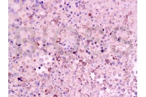 Formalin-fixed and paraffin embedded mouse lymphoma tissue labeled Anti-CD8 Polyclonal Antibody, Unconjugated (ABIN671391) at 1:200, followed by conjugation to the secondary antibody and DAB staining