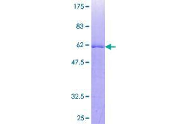TP53TG5 Protein (AA 1-290) (GST tag)