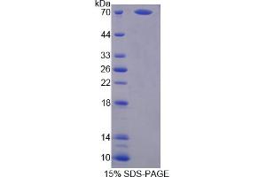 Image no. 1 for Proteasome 26S Subunit, Non ATPase 4 (AA 1-377) protein (His tag,GST tag) (ABIN6238356) (Proteasome 26S Subunit, Non ATPase 4 (AA 1-377) protein (His tag,GST tag))