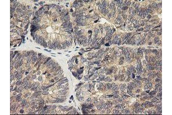 HRAS antibody