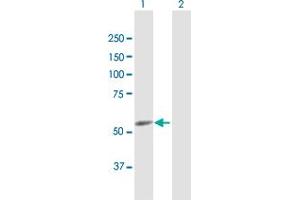Western Blotting (WB) image for anti-Cytochrome P450, Family 4, Subfamily F, Polypeptide 22 (CYP4F22) (AA 1-531) antibody (ABIN949834)