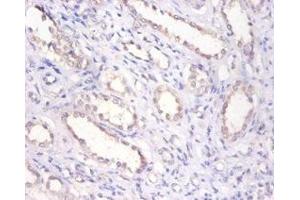Immunohistochemistry of paraffin-embedded human kidney tissue using ABIN7145696 at dilution of 1:100 (BMP6 antibody  (AA 382-513))