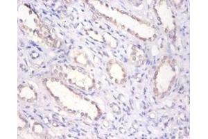 Immunohistochemistry of paraffin-embedded human kidney tissue using ABIN7145696 at dilution of 1:100
