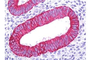Immunohistochemistry (IHC) image for anti-Keratin 18 (KRT18) (AA 164-395) antibody (ABIN1102771)
