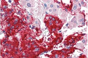 ABIN190848 (5µg/ml) staining of paraffin embedded Human Adrenal Gland. (Neuroligin 2 antibody  (Internal Region))