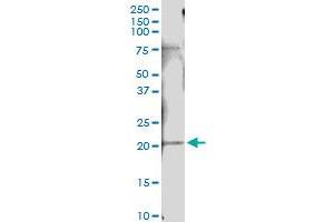 Immunoprecipitation of IFNA10 transfected lysate using anti-IFNA10 MaxPab rabbit polyclonal antibody and Protein A Magnetic Bead , and immunoblotted with IFNA10 purified MaxPab mouse polyclonal antibody (B01P) . (IFNA10 antibody  (AA 1-189))