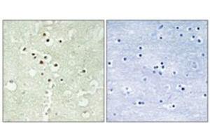 Immunohistochemical staining of human brain (left). (Cyclin H antibody  (pThr315))