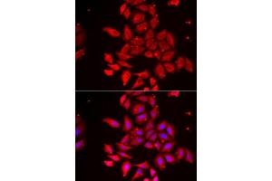 Immunofluorescence analysis of U2OS cell using TMOD4 antibody. (Tropomodulin 4 antibody)