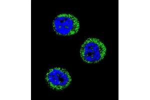Confocal immunofluorescent analysis of HP Antibody (Center) (ABIN654637 and ABIN2844334) with MDA-M cell followed by Alexa Fluor 488-conjugated goat anti-rabbit lgG (green). (Haptoglobin antibody  (Center))