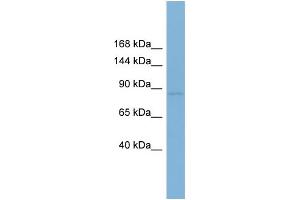 WB Suggested Anti-RSBN1  Antibody Titration: 0. (RSBN1 antibody  (N-Term))