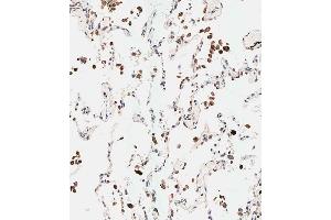 Immunohistochemical analysis of paraffin-embedded human lung tissue using (ABIN653920 and ABIN2843154) performed on the Leica® BOND RXm. (NUP210 antibody  (N-Term))