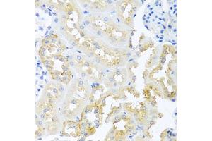 Immunohistochemistry (IHC) image for anti-Teratocarcinoma-Derived Growth Factor 1 (TDGF1) (AA 1-188) antibody (ABIN3021342)