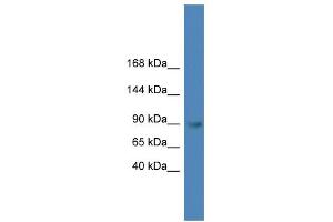 WB Suggested Anti-TLR4 Antibody Titration: 0. (TLR4 antibody  (C-Term))