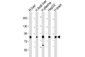 All lanes : Anti-Transferrin Antibody at 1:2000 dilution Lane 1: human liver lysate Lane 2: human fetal liver lysate Lane 3: human plasma lysate Lane 4: HepG2 whole cell lysate Lane 5: human brain lysate Lysates/proteins at 20 μg per lane. (Transferrin antibody  (AA 432-466))