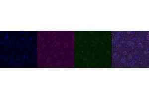 Immunohistochemistry (IHC) image for anti-Interleukin 12 alpha (IL12A) antibody (ABIN7456134) (IL12A antibody)