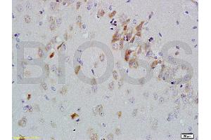 Formalin-fixed and paraffin embedded rat brain labeled with Anti-GDNF-Receptor-alpha-2 Polyclonal Antibody, Unconjugated (ABIN724235) 1:200 followed by conjugation to the secondary antibody and DAB staining (GFRA2 antibody  (AA 301-360))