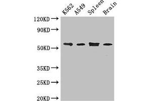 Western Blotting (WB) image for anti-Coronin, Actin Binding Protein, 1C (CORO1C) (AA 351-464) antibody (ABIN7148601)