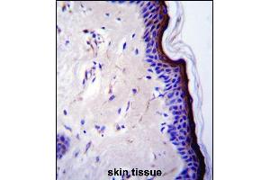 p53 Antibody (T55) (ABIN390200 and ABIN2840687) immunohistochemistry analysis in formalin fixed and paraffin embedded human skin tissue followed by peroxidase conjugation of the secondary antibody and DAB staining. (p53 antibody  (AA 33-62))