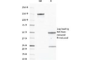 SDS-PAGE Analysis of Purified CD40 Mouse Monoclonal Antibody ABIN6383879. (CD40 antibody  (Extracellular Domain))