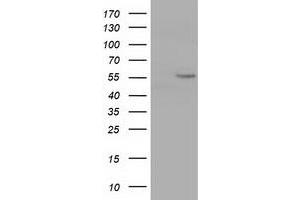 HEK293T cells were transfected with the pCMV6-ENTRY control (Left lane) or pCMV6-ENTRY CYP1A2 (Right lane) cDNA for 48 hrs and lysed. (CYP1A2 antibody)