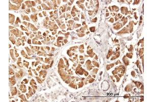 Immunoperoxidase of purified MaxPab antibody to CPA2 on formalin-fixed paraffin-embedded human pancreas. (Carboxypeptidase A2 antibody  (AA 1-417))