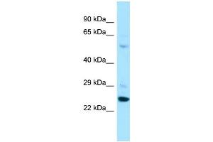 Host: Rabbit Target Name: PARS2 Sample Type: A549 Whole Cell lysates Antibody Dilution: 1. (PARS2 antibody  (C-Term))