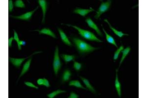 Immunofluorescence staining of Hela cells with ABIN7162338 at 1:133, counter-stained with DAPI. (OTUD7B antibody  (AA 235-347))