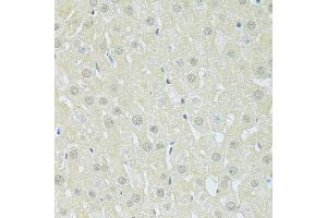 Immunohistochemistry of paraffin-embedded rat liver using SLC40A1 antibody (ABIN6292414) at dilution of 1:100 (40x lens).