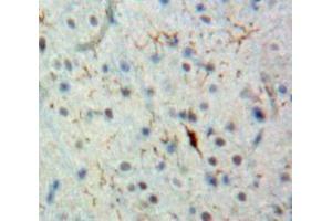 Used in DAB staining on fromalin fixed paraffin-embedded Brain tissue (BCL9 antibody  (AA 1118-1327))