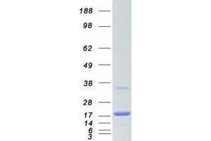 Western Blotting (WB) image for Ubiquitin-Conjugating Enzyme E2N (UBE2N) protein (Myc-DYKDDDDK Tag) (ABIN2734860)