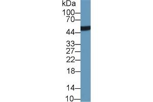 Detection of LRG1 in Human Urine using Monoclonal Antibody to Leucine Rich Alpha-2-Glycoprotein 1 (LRG1) (LRG1 antibody  (AA 37-340))