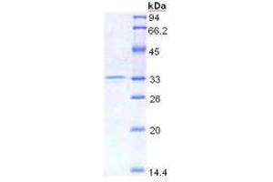 SDS-PAGE analysis of Mouse HMG1 Protein.
