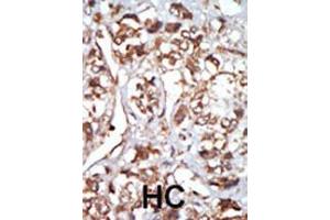 Immunohistochemistry (Paraffin-embedded Sections) (IHC (p)) image for anti-Eukaryotic Translation Initiation Factor 2-alpha Kinase 1 (EIF2AK1) (AA 1-30), (N-Term) antibody (ABIN392638)