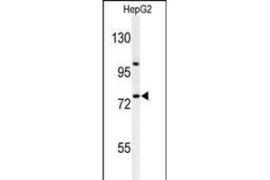 Western blot analysis of ZN Antibody (Center) (ABIN653731 and ABIN2843038) in HepG2 cell line lysates (35 μg/lane). (ZNF202 antibody  (AA 342-370))