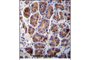 Immunohistochemistry (Paraffin-embedded Sections) (IHC (p)) image for anti-Mannosidase, Alpha, Class 2A, Member 2 (MAN2A2) (AA 767-796) antibody (ABIN656432)