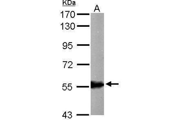 ALDH6A1 anticorps