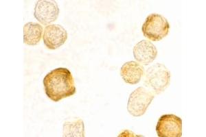 Immunocytochemistry staining of HeLa cells using AP30343PU-N FLIP antibody at 2 μg/ml. (FLIP antibody  (C-Term))