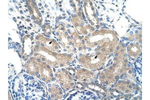 ADH1B antibody was used for immunohistochemistry at a concentration of 4-8 ug/ml to stain Epithelial cells of renal tubule (arrows) in Human Kidney. (ADH1B antibody)