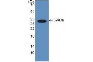 Detection of Recombinant DDIT3, Human using Polyclonal Antibody to DNA Damage Inducible Transcript 3 (DDIT3) (DDIT3 antibody  (AA 1-169))