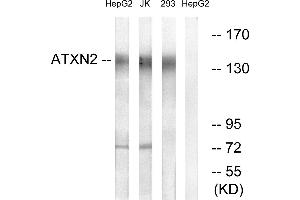Western blot analysis of extracts from HepG2 cells, Jurkat cells and 293 cells, using ATXN2 antibody.